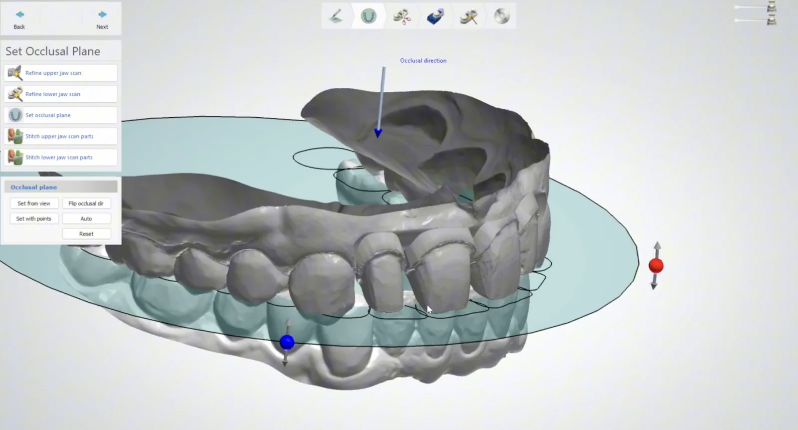 Strumento Set Occlusal Plane di Model Builder con le scansioni superiore e inferiore orientate sul piano.
